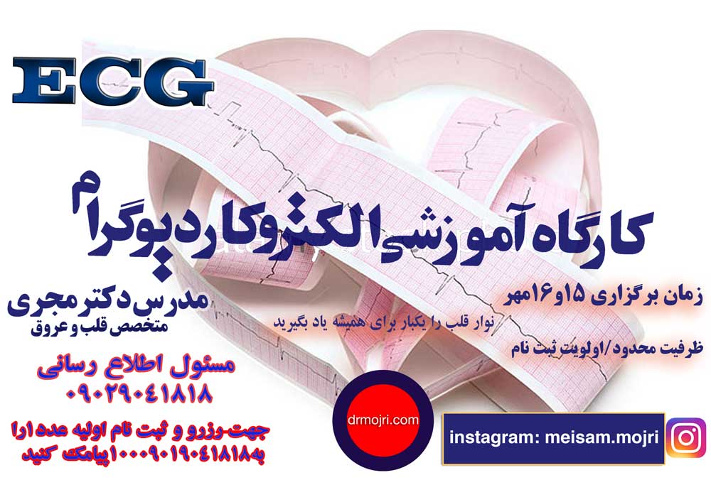 site-ecg-tehran